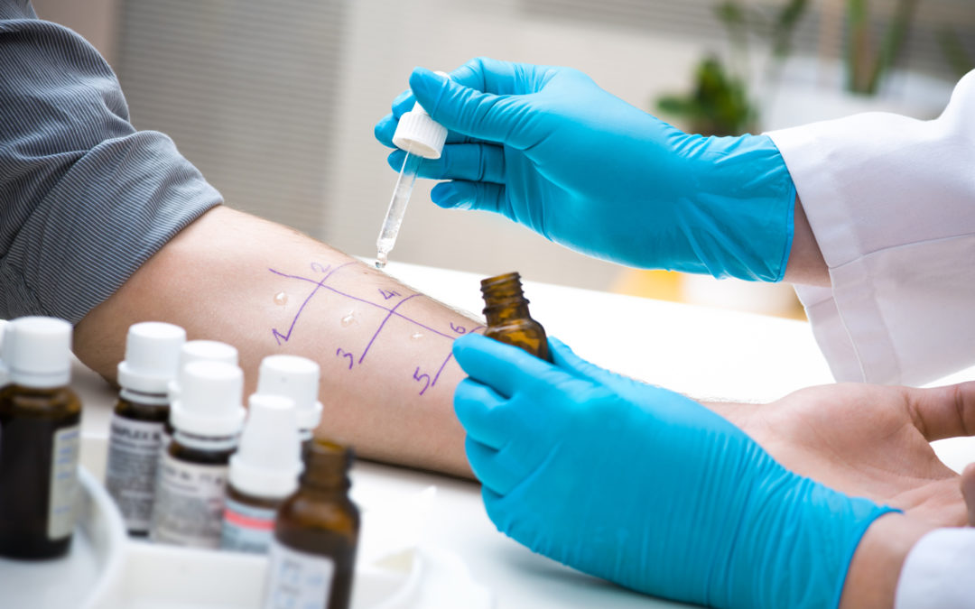 What Is An Allergy Skin Test?