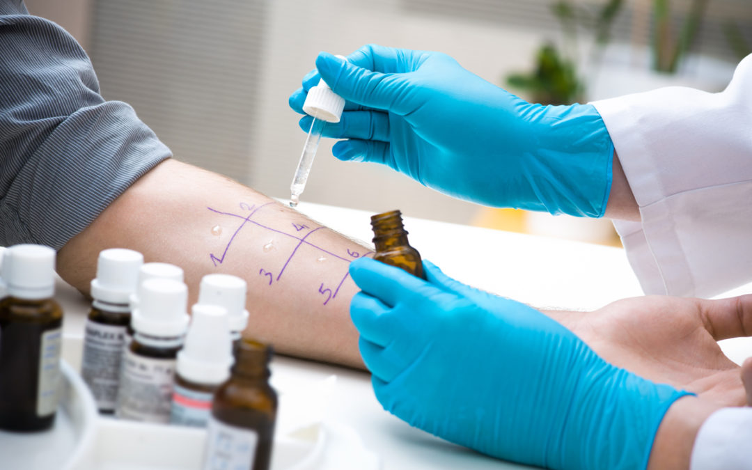 What Is An Allergy Skin Test Premier Allergy